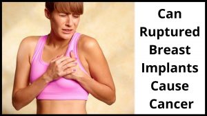 Can Ruptured Breast Implants Cause Cancer