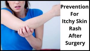 Prevention For Itchy Skin Rash After Surgery