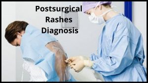 Postsurgical Rashes Diagnosis