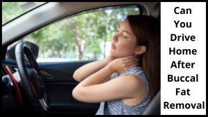 Can You Drive Home After Buccal Fat Removal