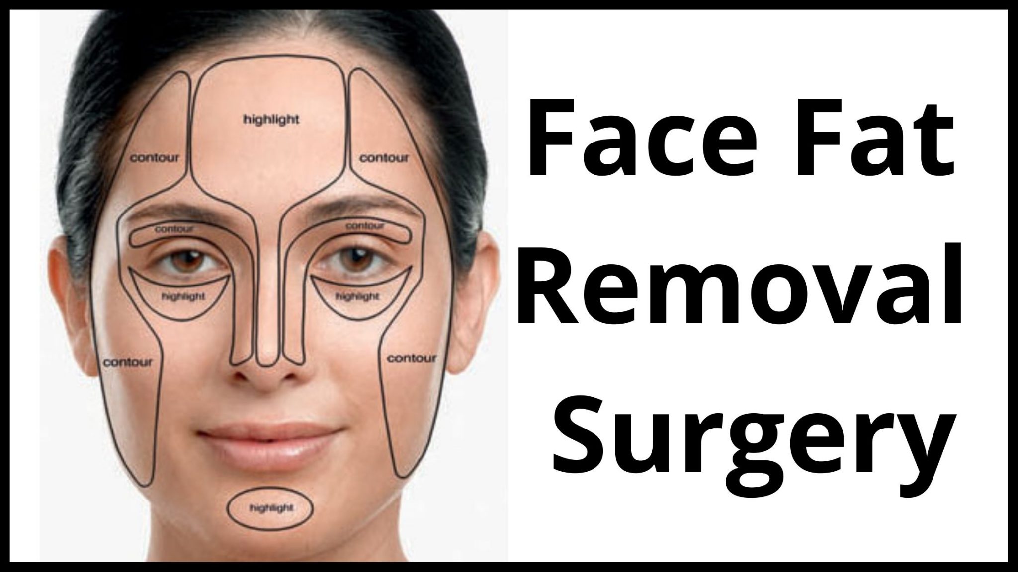 face-fat-removal-surgery-procedure-cost-candidates-complications