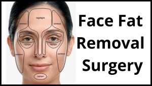 Face Fat Removal Surgery