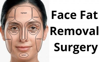 Face Fat Removal Surgery – Procedure, Cost, Candidates, Complications.