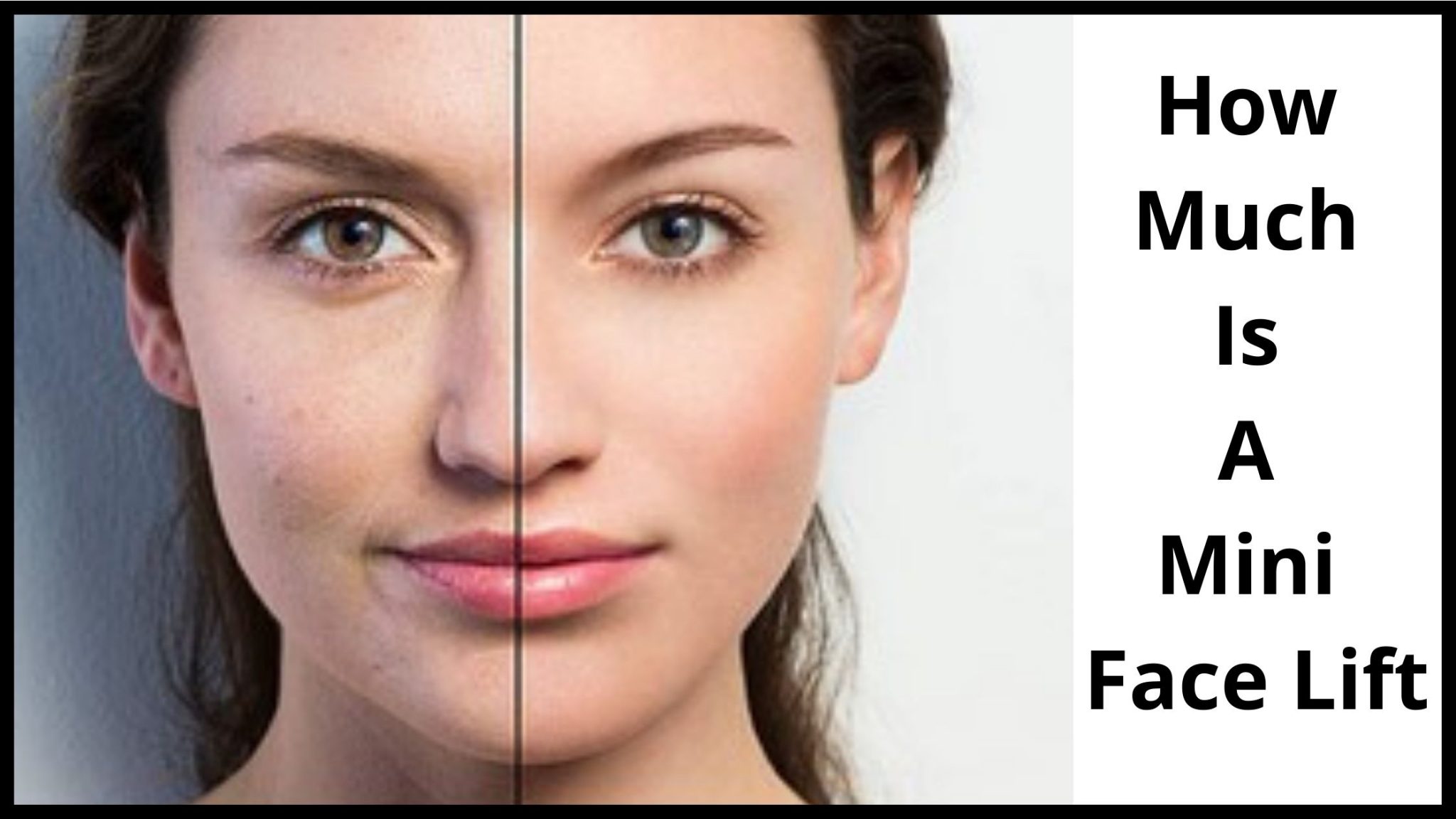 How Much Is A Mini Face Lift Cost and What is done.