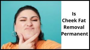 Is Cheek Fat Removal Permanent