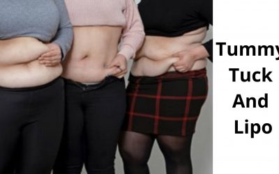 Tummy Tuck And Lipo – Can you have lipo and tummy tuck at the same time?