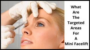 What Are The Targeted Areas For A Mini Facelift