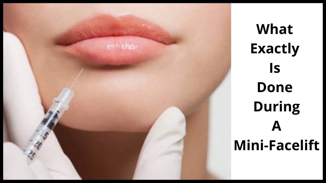 How Much Is A Mini Face Lift Cost and What is done.