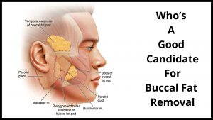 Who’s A Good Candidate For Buccal Fat Removal