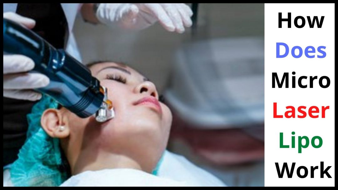 Micro Laser Liposuction Cost And other things you need to KNOW!