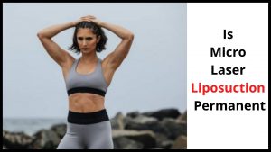 Is Micro Laser Liposuction Permanent